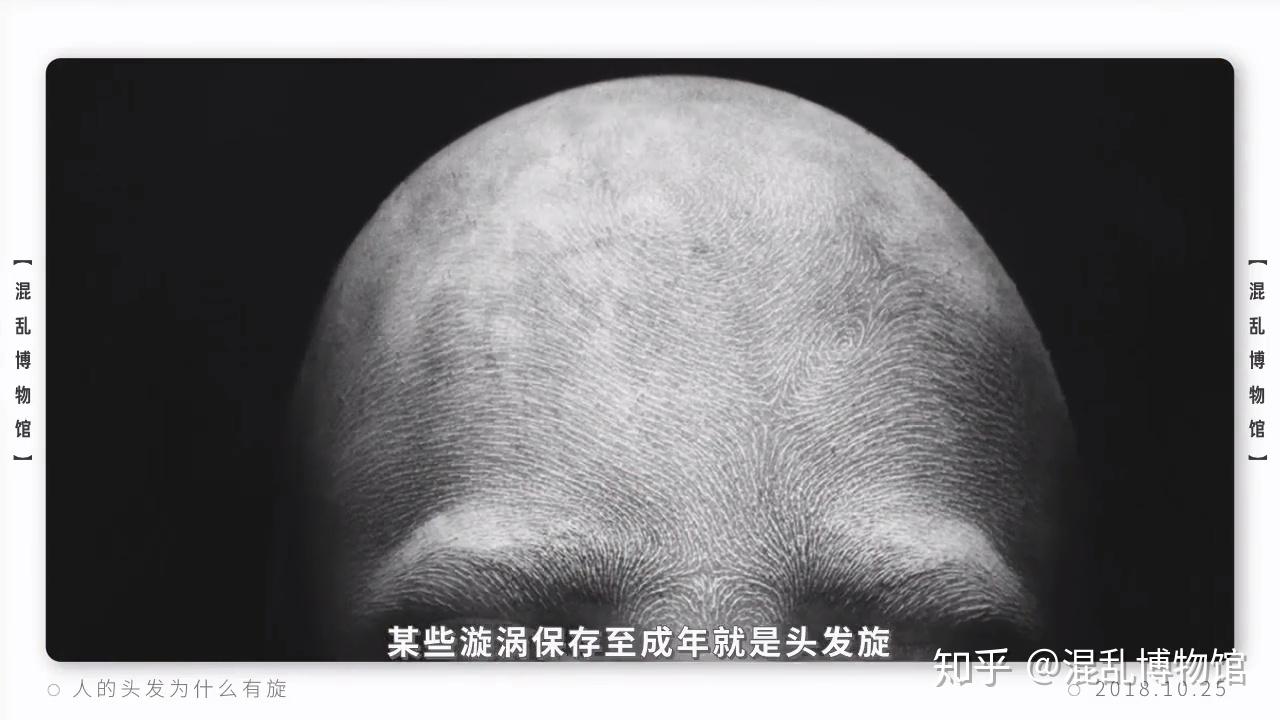 为什么人的头上会有发旋？ - 知乎