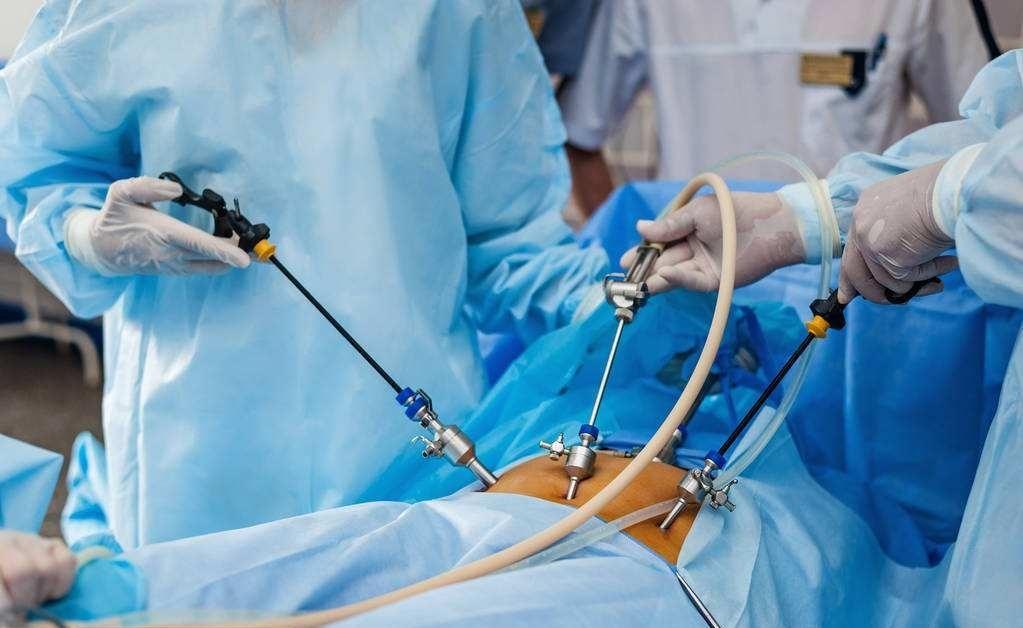 子宫内膜异位症和不孕症可以手术治疗吗