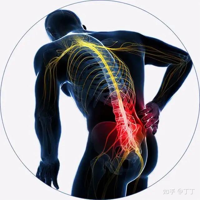 腰肌劳损的自我治疗和恢复的方法