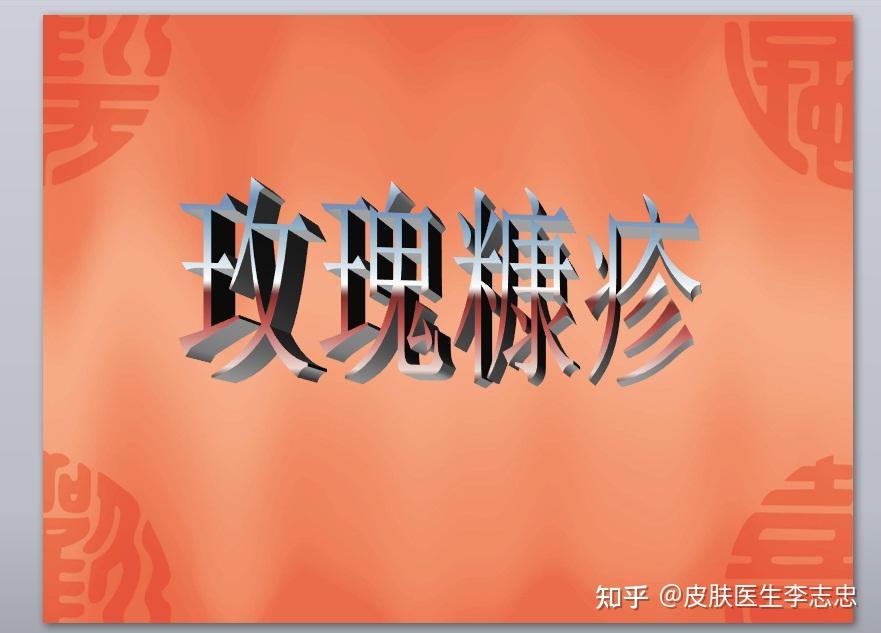 古籍中无玫瑰糠疹说的,而是叫风热疮或者风癣,其特点是:初发多在躯干