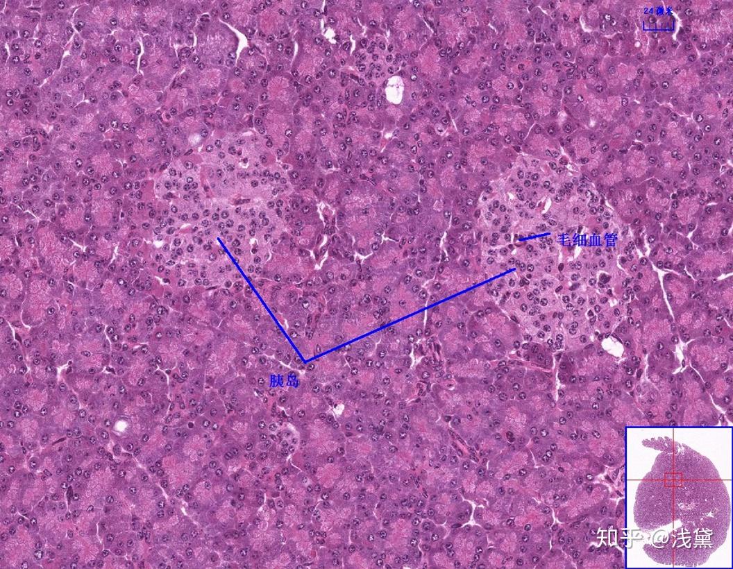 垂体(嫌色细胞,嗜酸