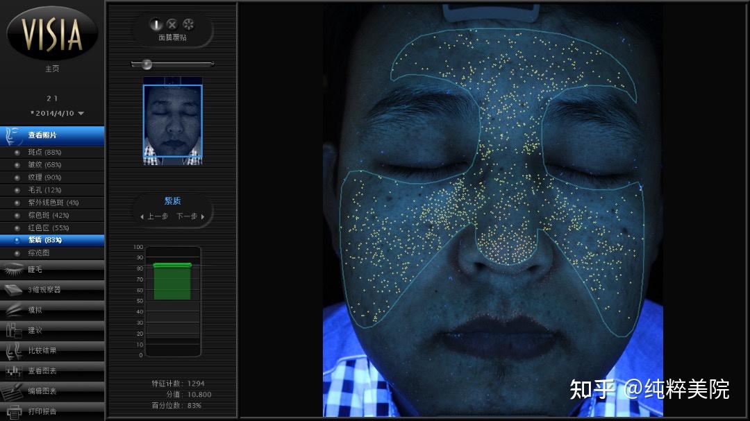 visia皮肤测试结果怎么看?