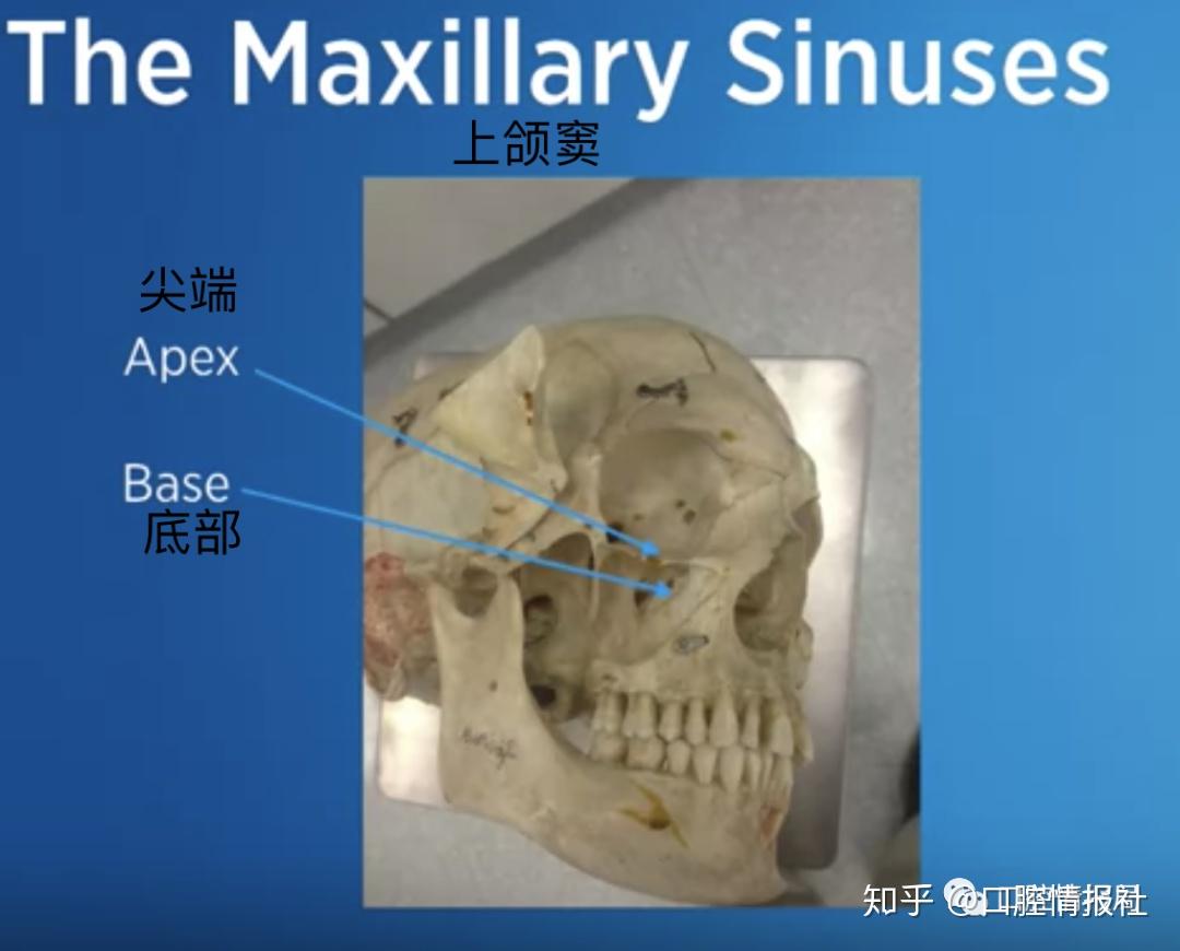 【口腔种植系列】2.2.1 解剖学:上颌骨 - 知乎