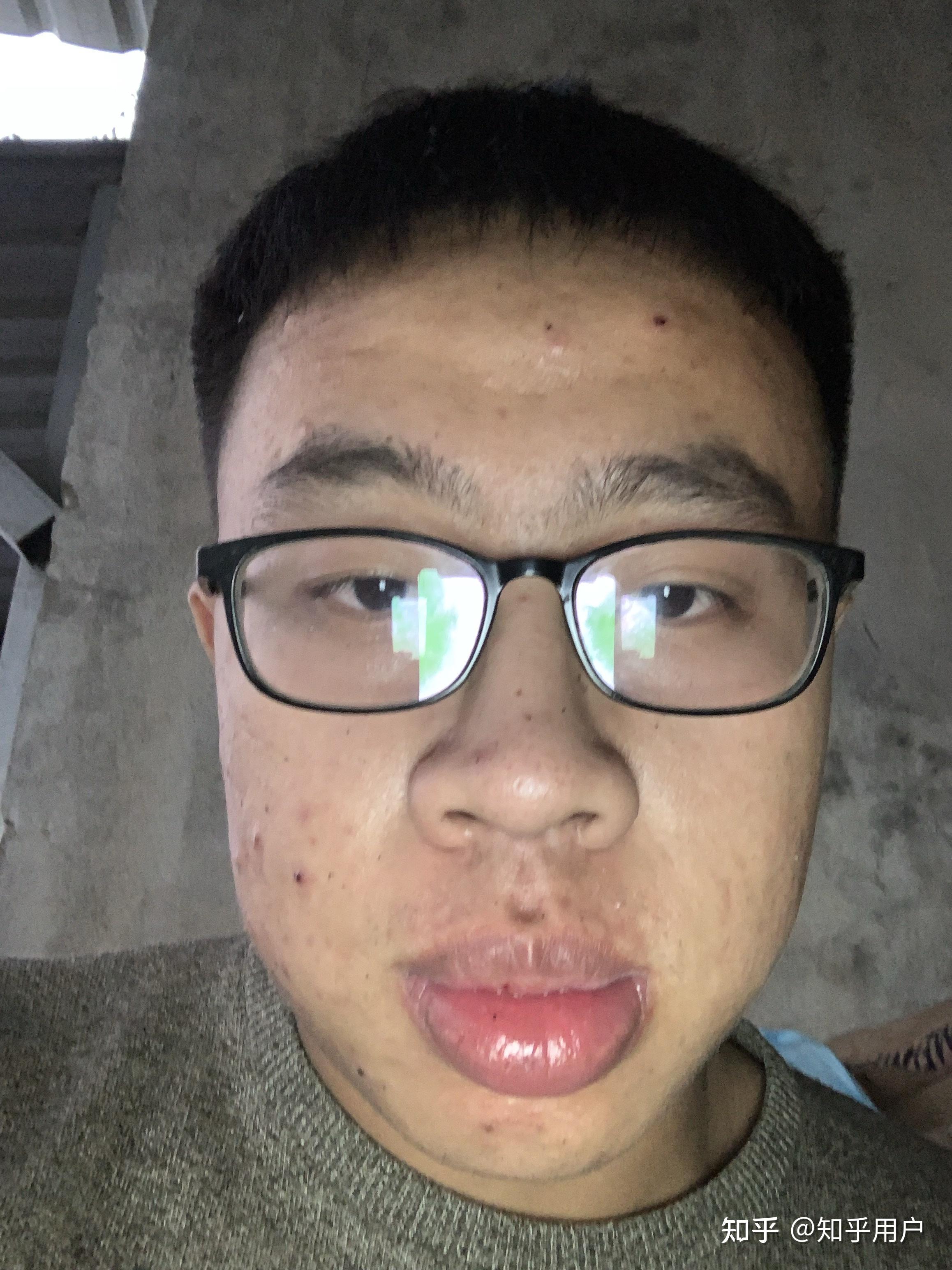 有没有长得丑的男生照片分享一下.我想知道什么样算丑 ? - 知乎