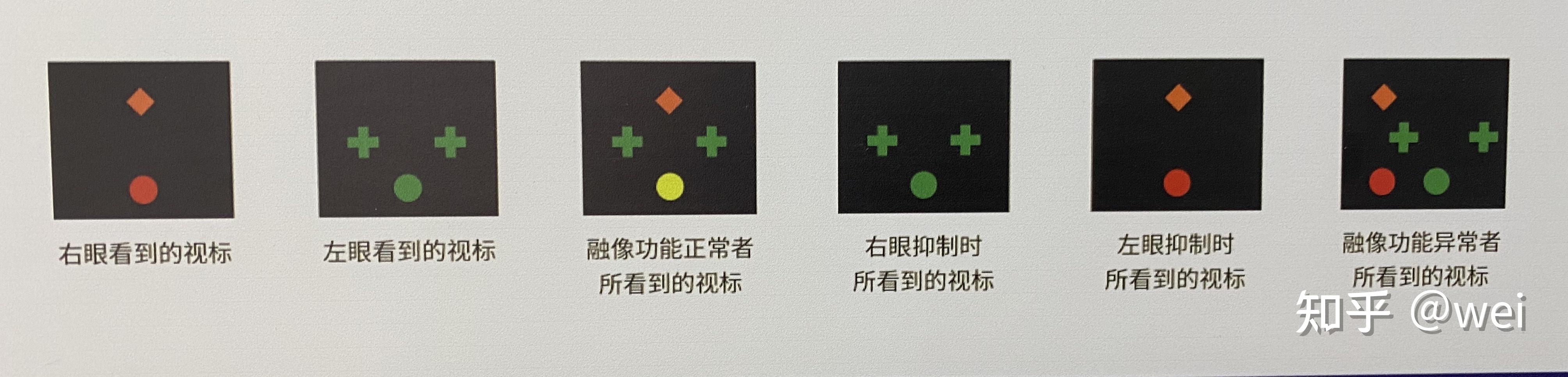 worth 4点的功能介绍及测量方法