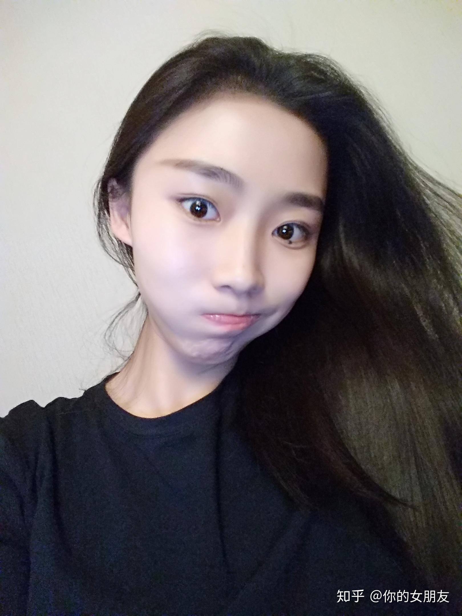 日式无痕双眼皮靠谱吗?