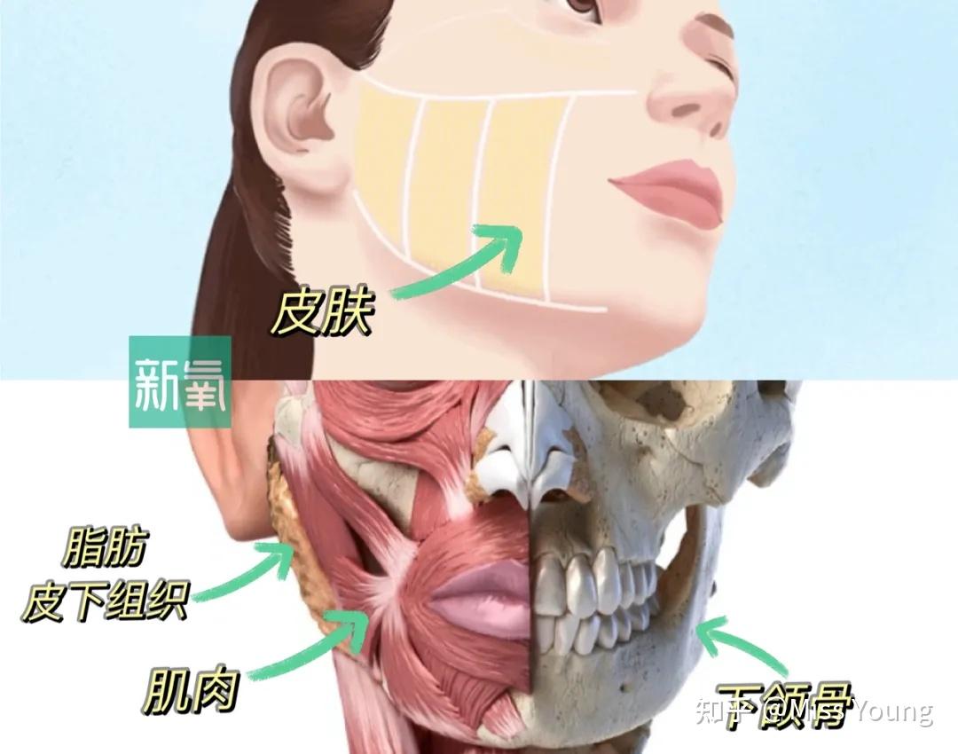 30岁,面部下垂,还有些发腮,法令纹也比之前严重了一些,有什么好的解决方法吗? - 知乎
