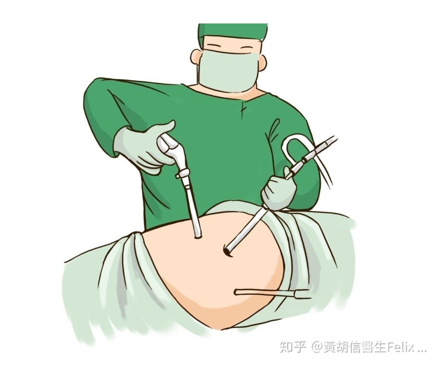 内视镜——宫腔镜:宫腔镜手术是指:采用冷光源内窥镜经阴道宫颈进入宫