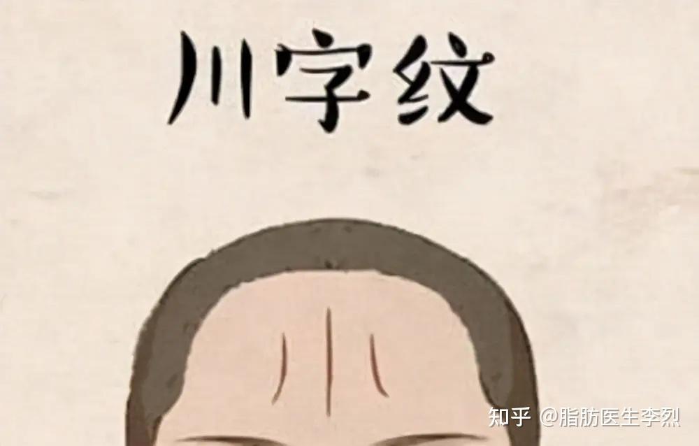 川字纹的产生！该如何来解决呢？ - 知乎