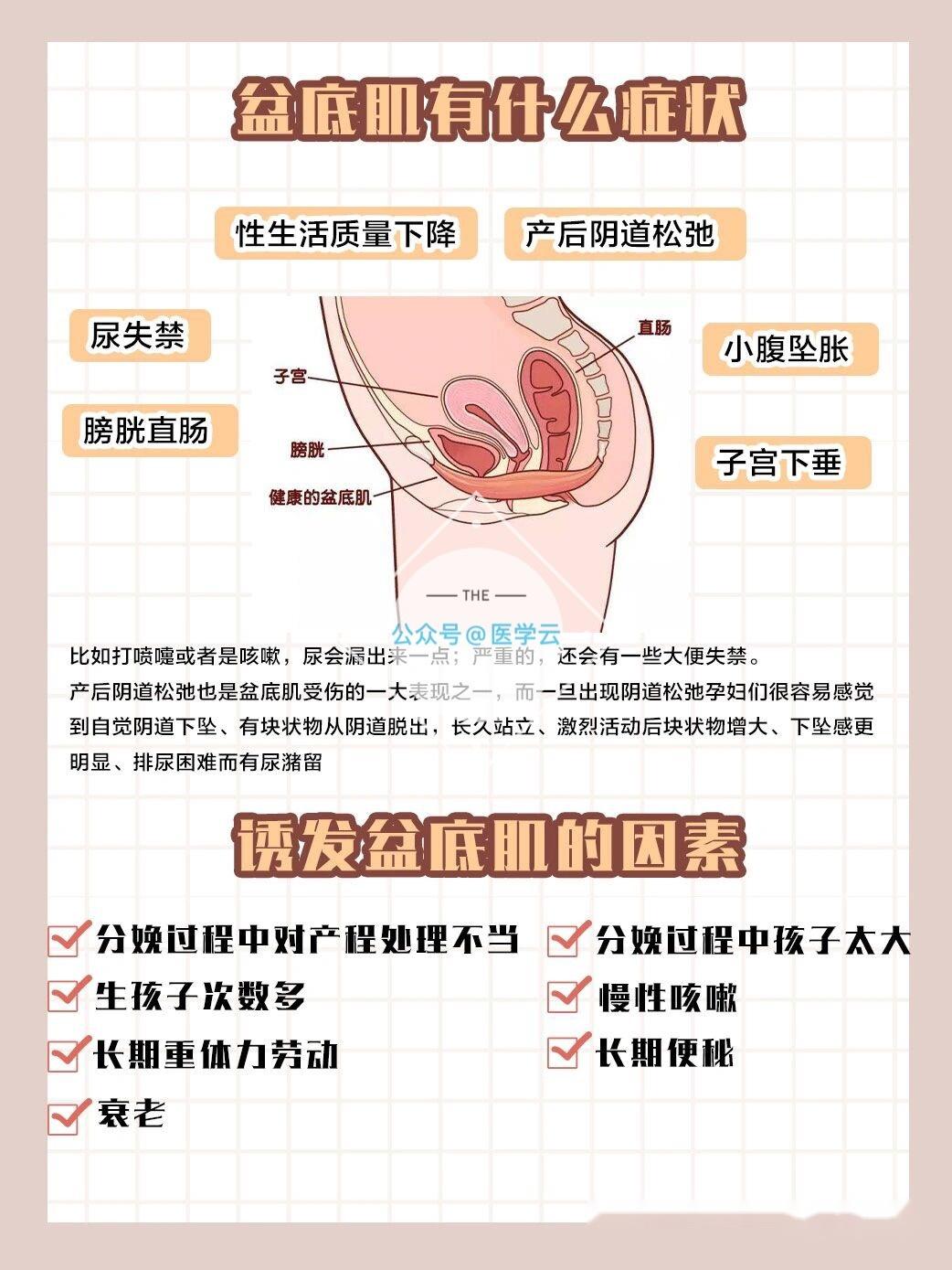 【产后修复】盆底肌修复注意事项