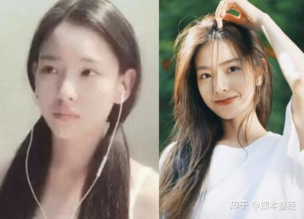 你们觉得孙一宁颜值做过整形吗?