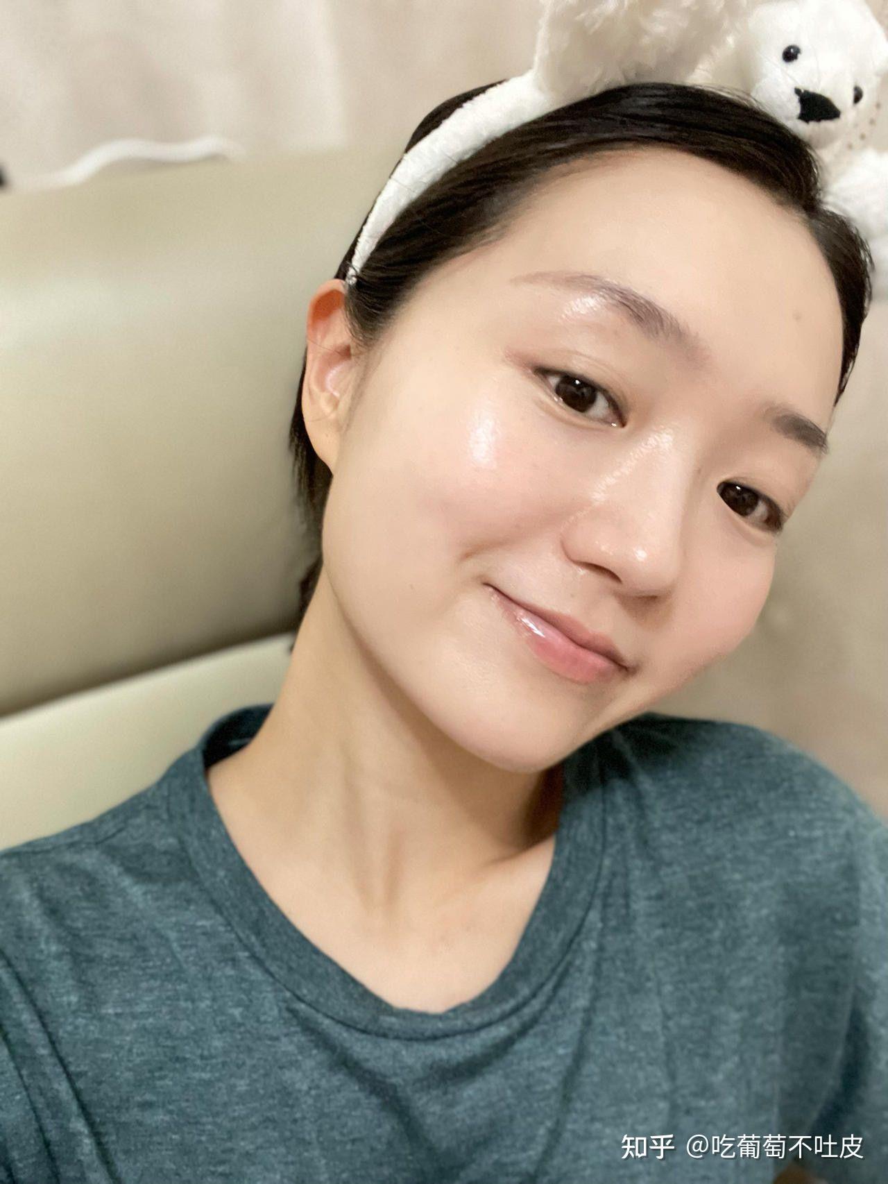 如何祛斑淡斑你们脸上的斑点都是怎么去掉的