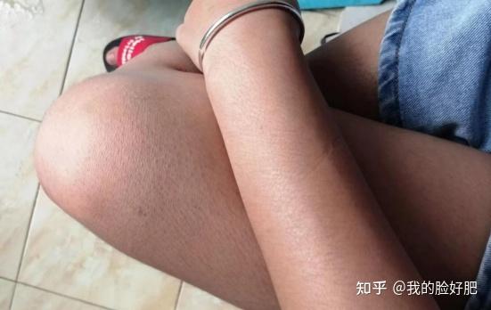 大学生皮肤又黑又黄要怎么才能变的全身白