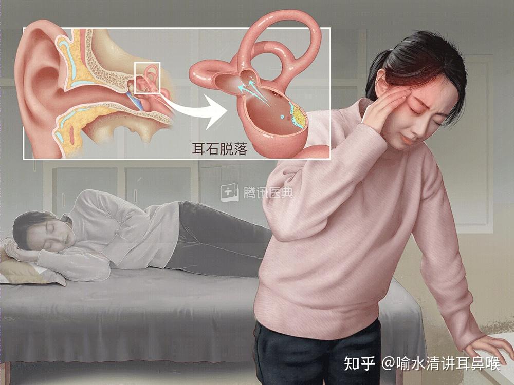 这5种关于耳石症的治疗方法,你都掌握了吗?