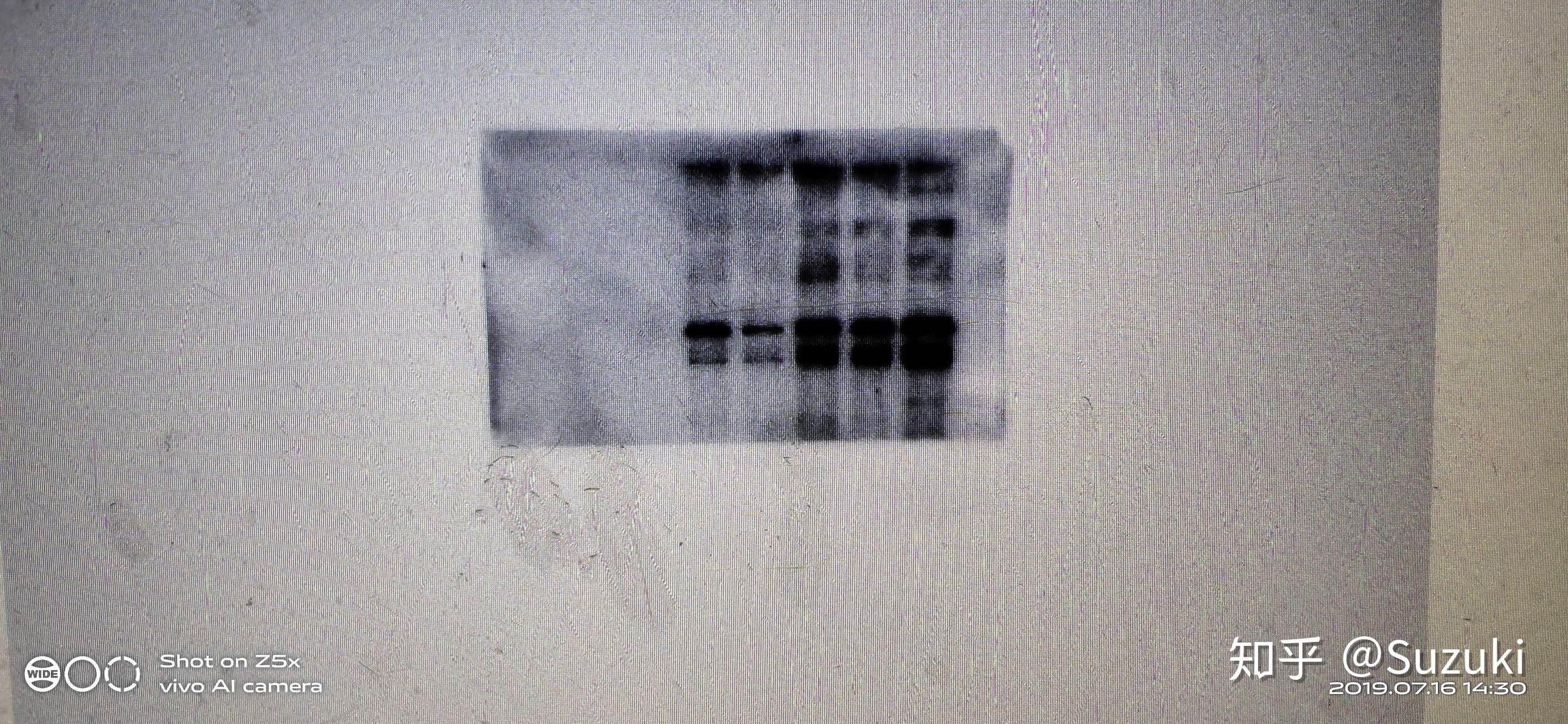 你们做出来最丑陋的westernblot长啥样是什么原因造成的