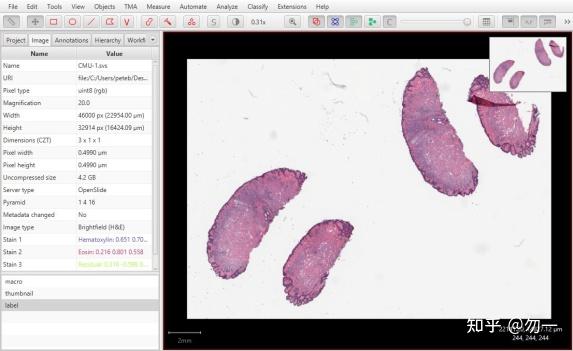 【数字病理】病理图像开源分析工具QuPath入门 - 知乎
