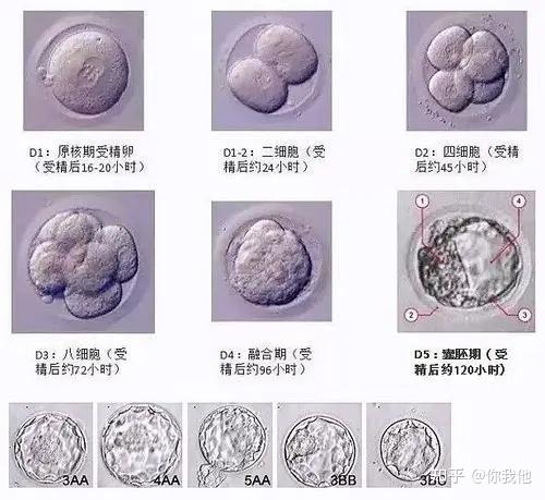 一,试管胚胎等级是什么意思?
