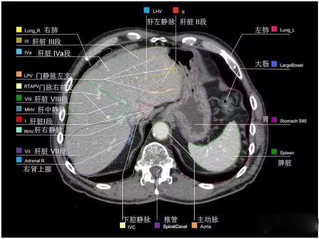 外科医生阅片能力:看完它,再也没有看不懂的腹部CT - 知乎