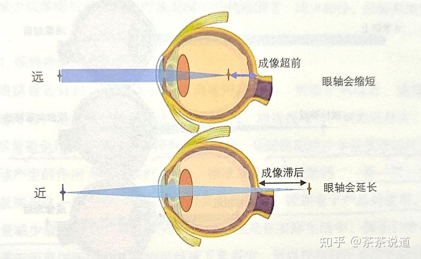 近视防控这样做,才真的有效!(教你一秒看懂验光报告单)