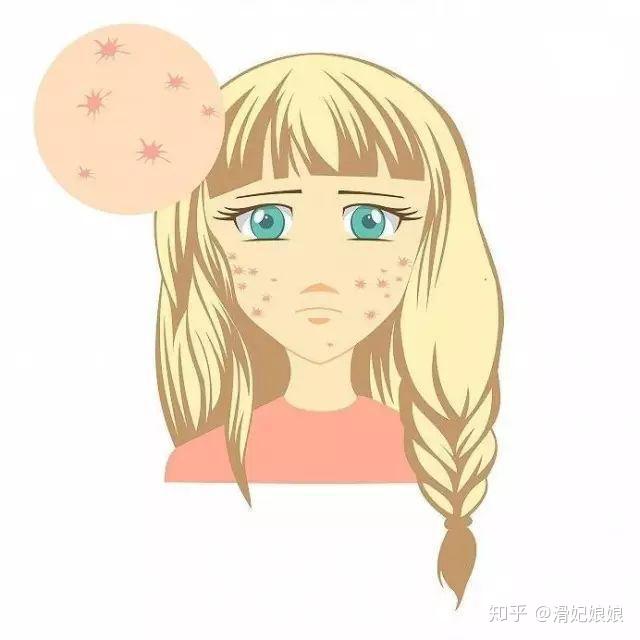 去闭口的5个方法你get了吗