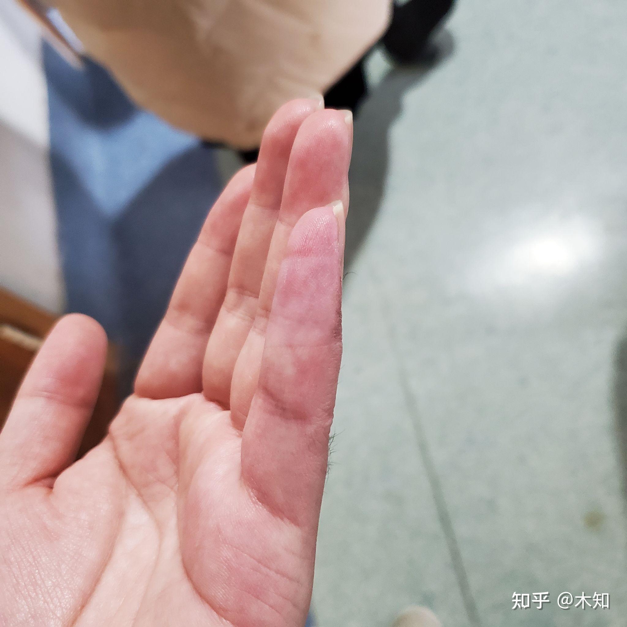 v2-a0675a3e365ef135eec0ca4abdcac38c_r.jpg