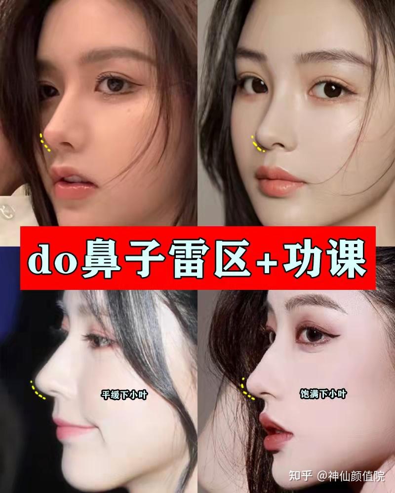 什么叫做妈生款鼻型哪里可以做妈生款自然隆鼻