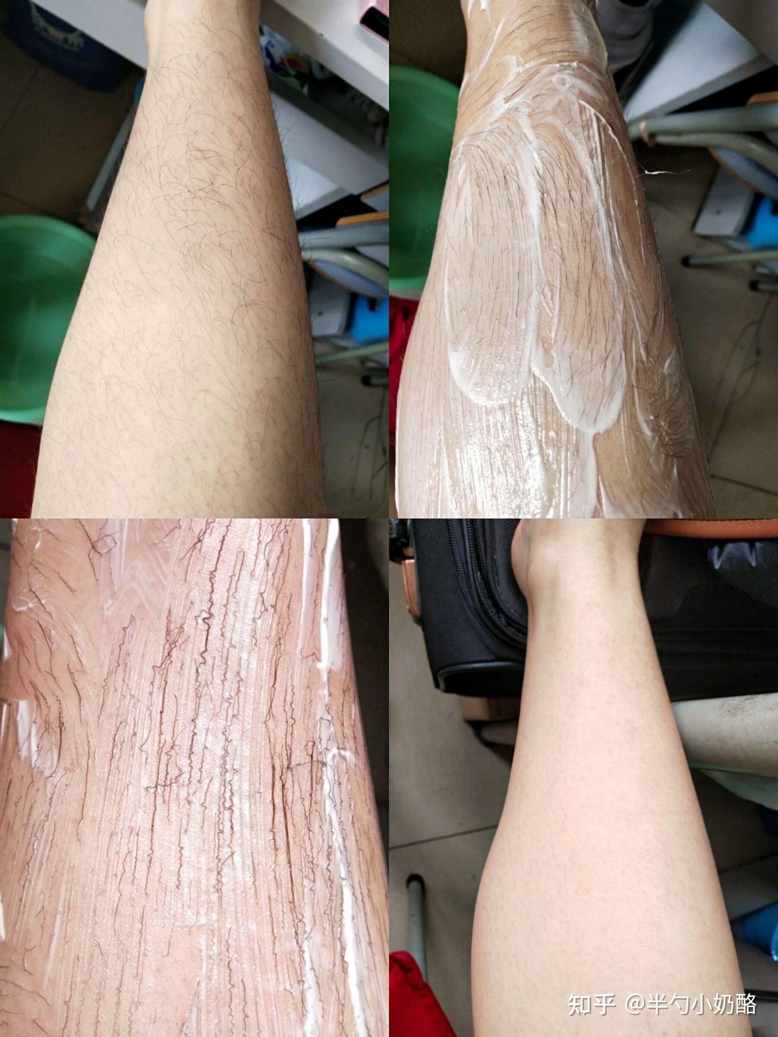 你用过最温和可以抑制毛发长的脱毛膏是什么