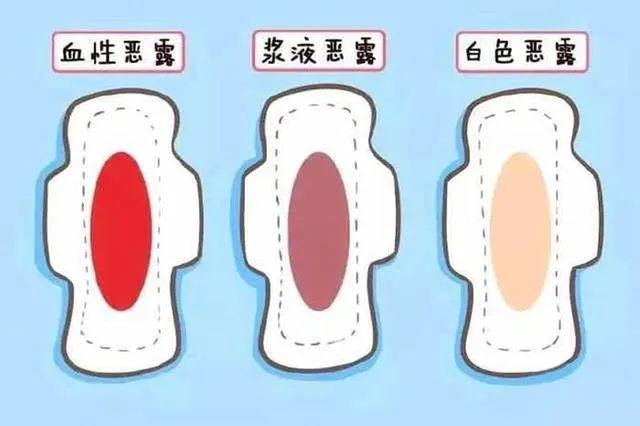 恶露？大姨妈复潮？产后这种异常出血要警惕 - 知乎