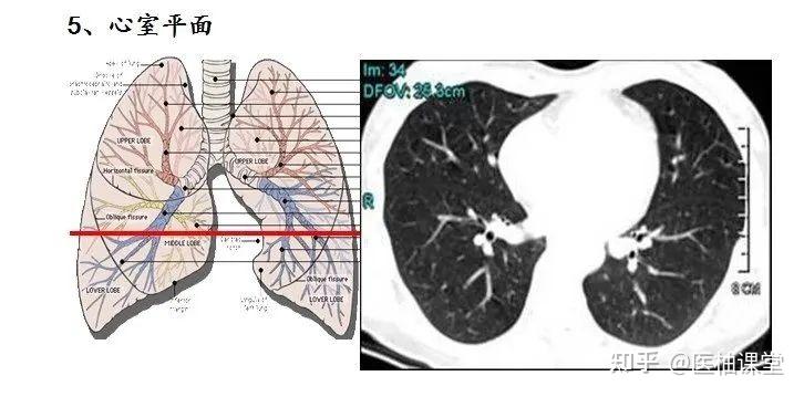 ct肺段定位口诀,图文结合异常清晰!