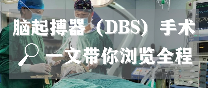 DBS手术流程详解，一文带你浏览全程 - 知乎