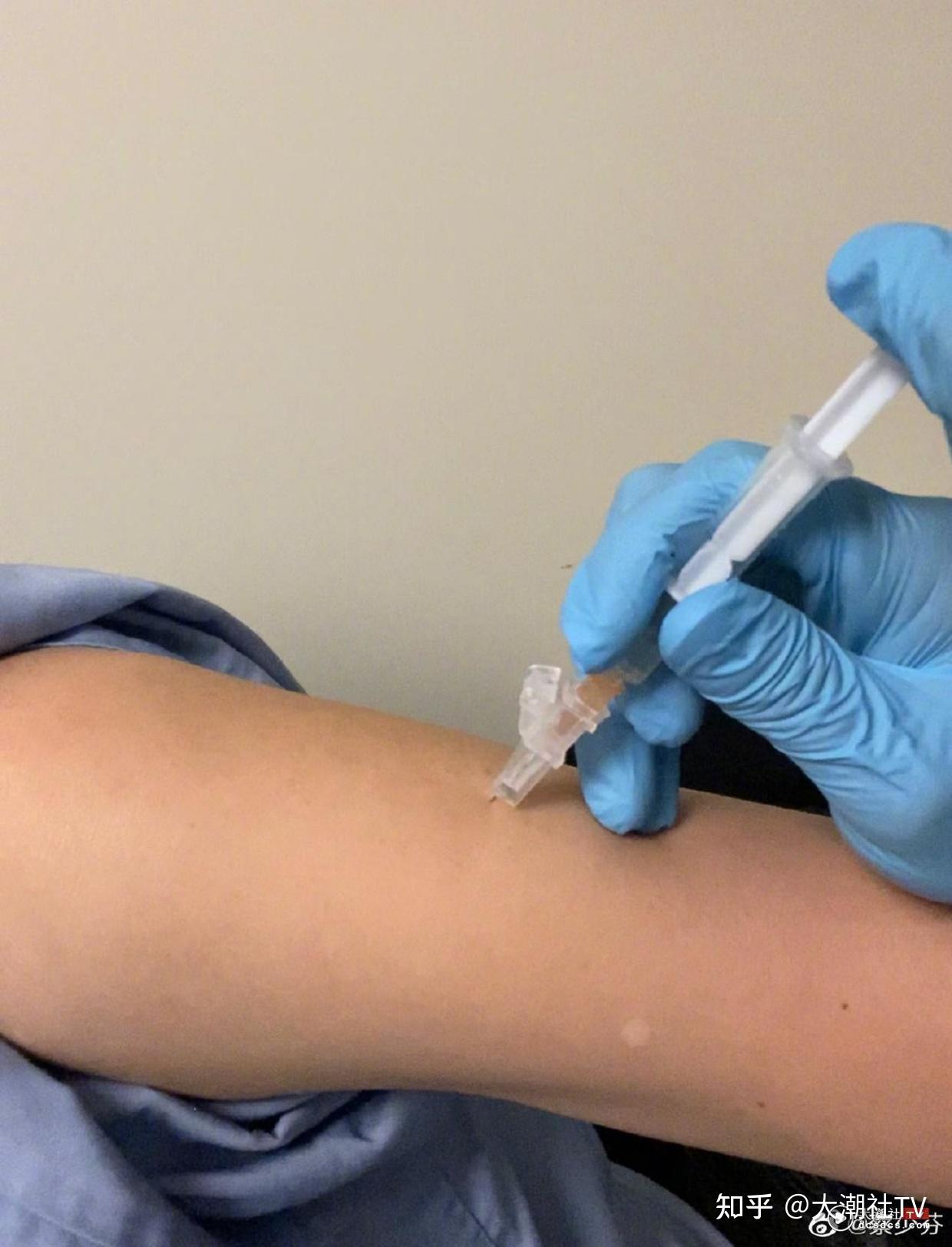 蔡少芬受伤中断录影赶赴医院自爆被狗咬医生建议打狂犬疫苗针