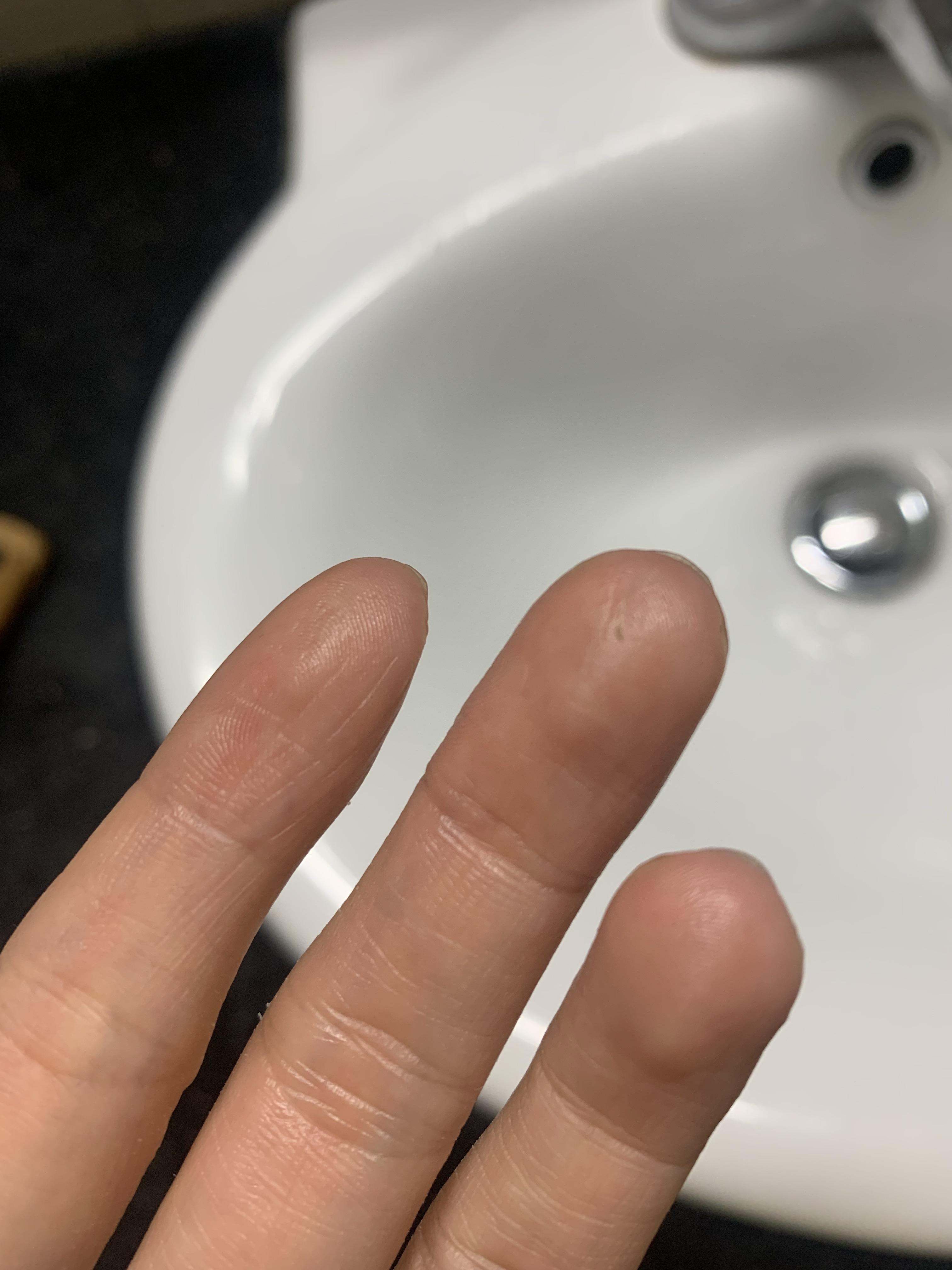 莫吉隆斯症属于反社会型人格障碍吗? - 知乎