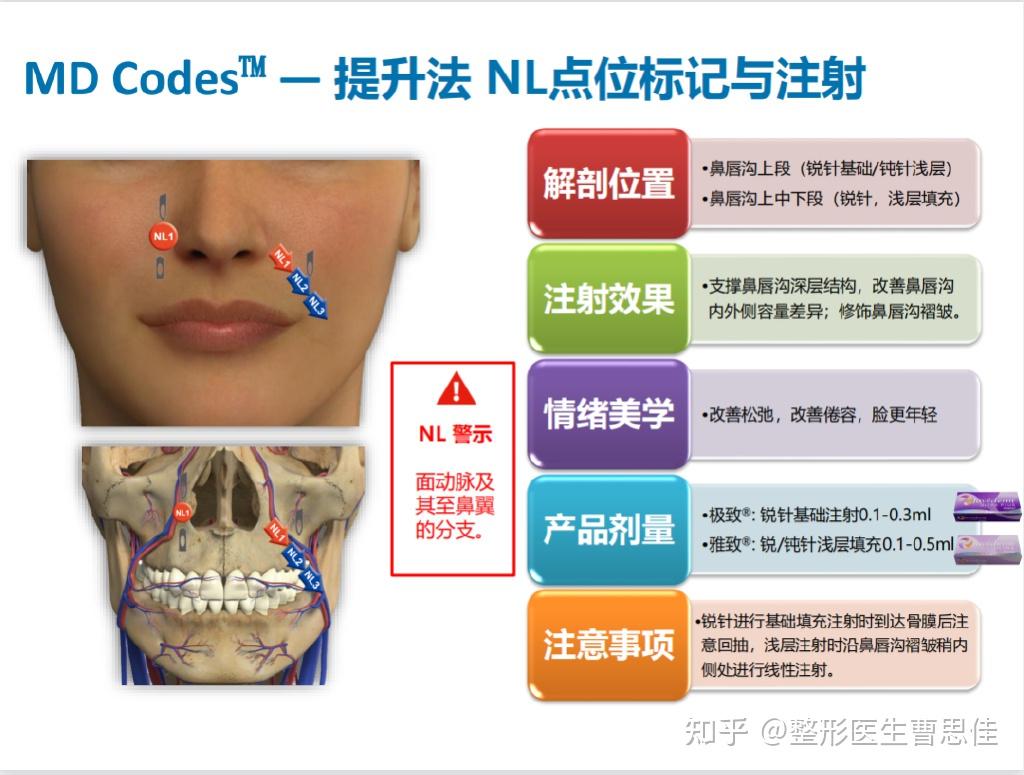 mdcodes注射法我为什么不教