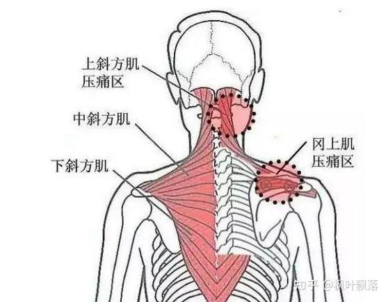 筋膜炎能自愈吗