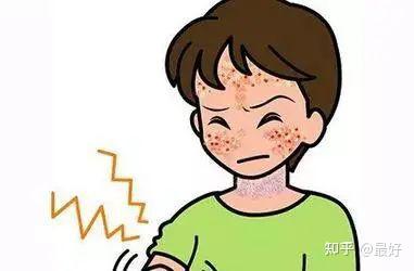 皮肤对“阳光”过敏怎么办? - 知乎