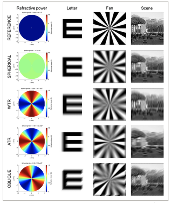 散光多少度算是高度散光?散光又如何改善?有办法治愈吗?