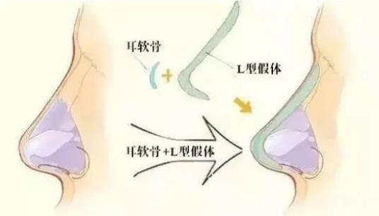 v2-a172d788ca3d291e44fa9d8667251cff_1440w.jpg?source=172ae18b