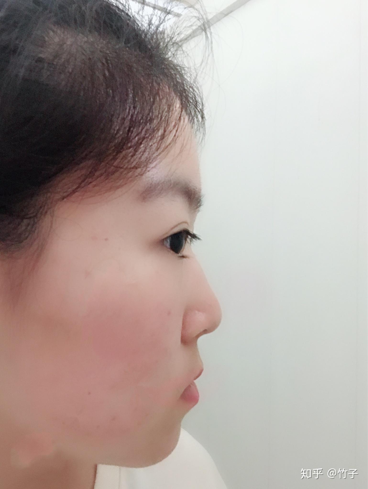 有一个超级扁平的侧脸是一种什么样的体验? - 知乎