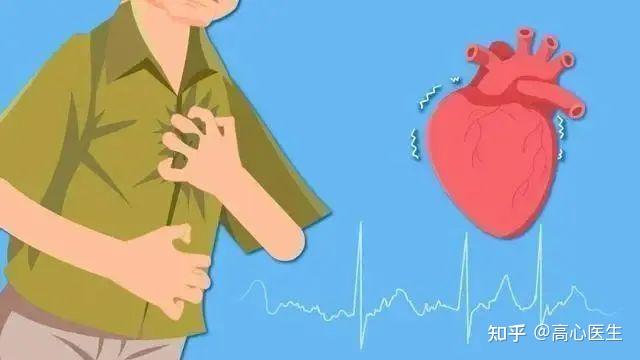 心脏最后的倔强—「室颤」 - 知乎