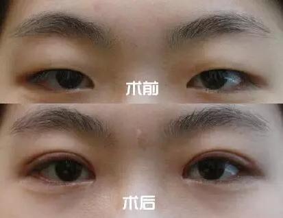 v2-a1a75b05dcd7f01e92b932827165deff_1440w.jpg?source=172ae18b