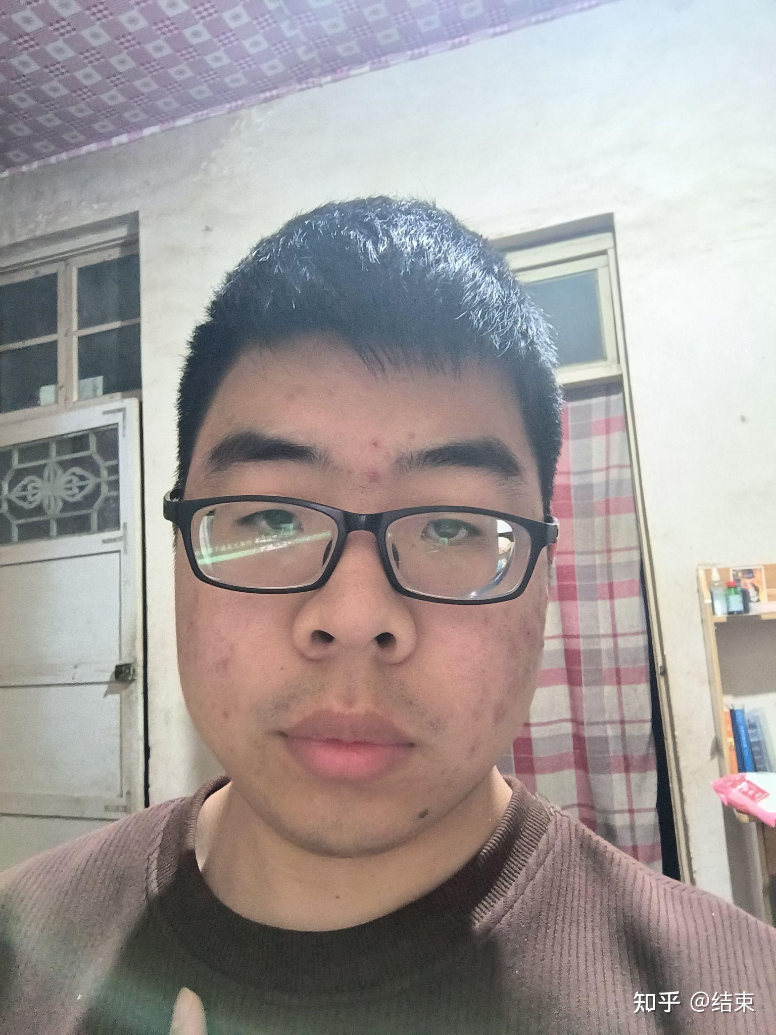 有没有长得丑的男生照片分享一下.我想知道什么样算丑 ?