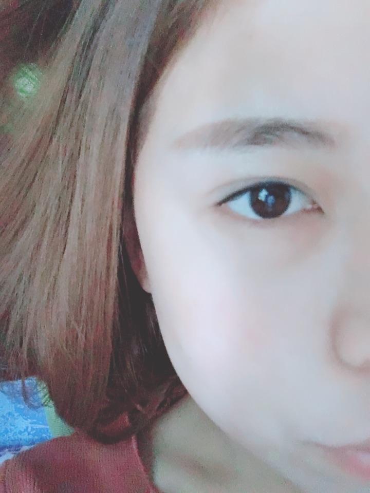 光纤溶脂,面部吸脂,瘦脸针,请做过的女生来,不要