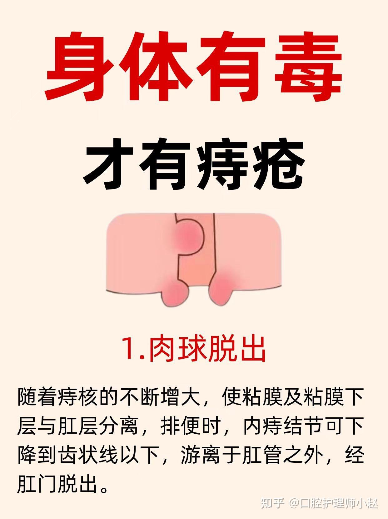 人为什么会得痔疮