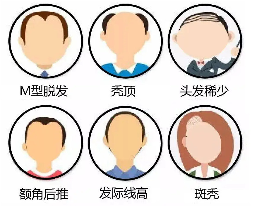 头发不好怎么养发?春夏交替如何养发护发才是正确的 - 知乎
