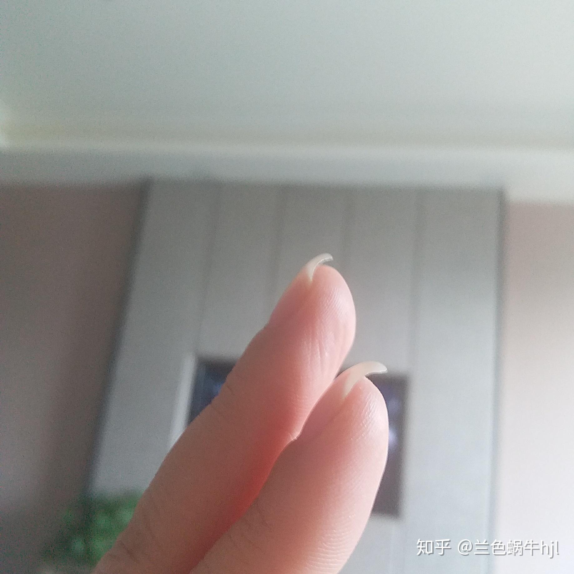 指甲长出的一半向下弯曲是什么情况? - 知乎