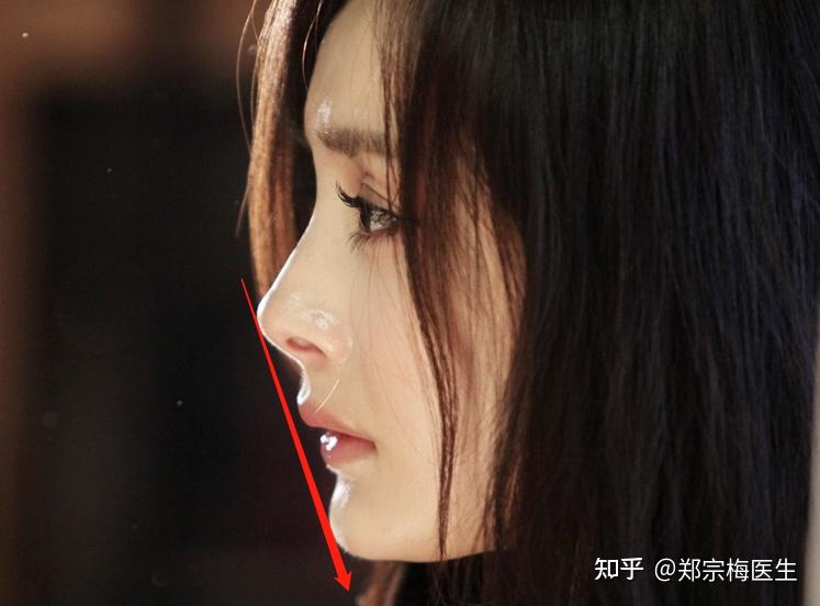 怎么改善侧脸上嘴唇凸起? - 知乎