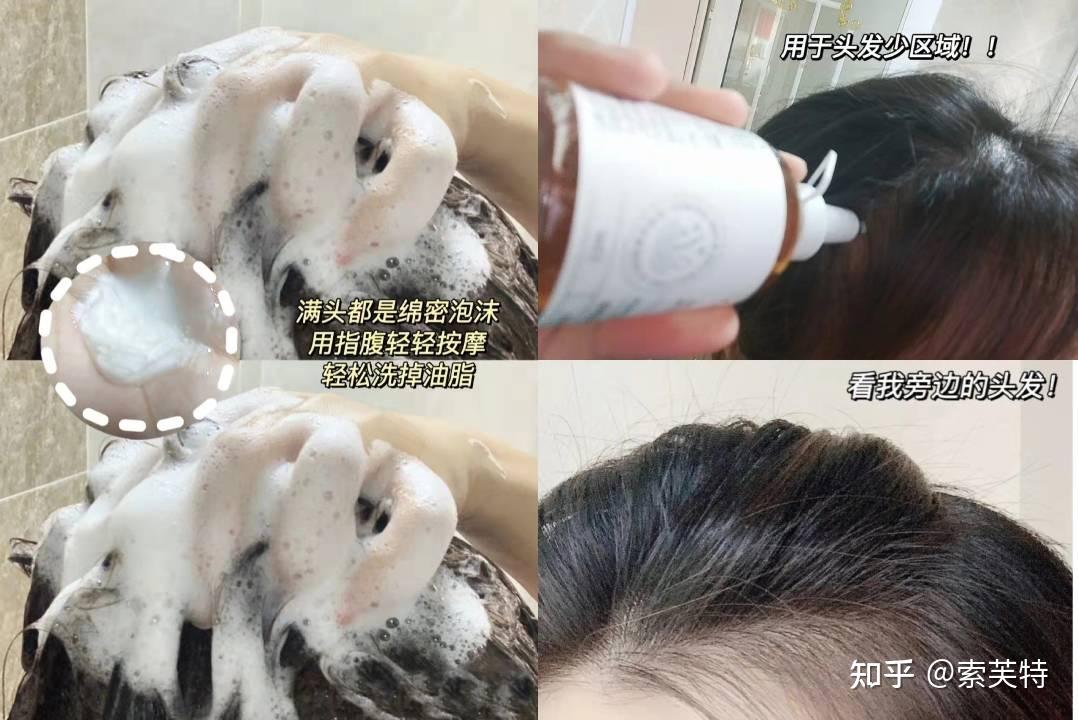 防脫髮洗髮水哪種好防脫髮洗髮水品牌防脫髮小技巧科普