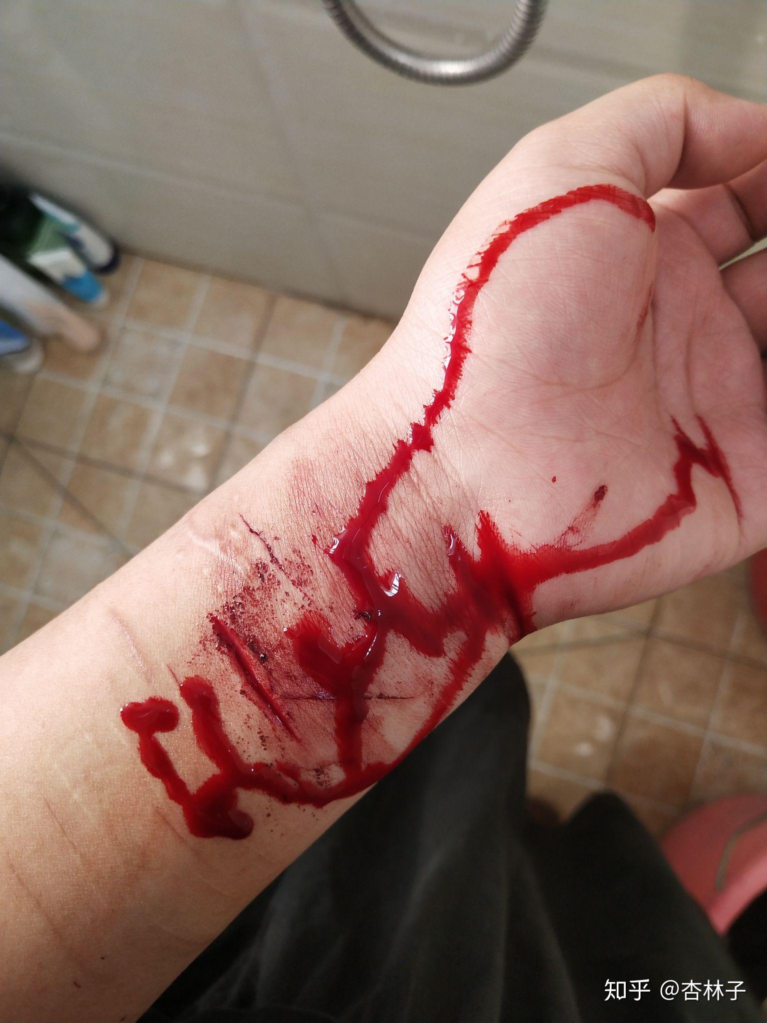 自残属于什么心理