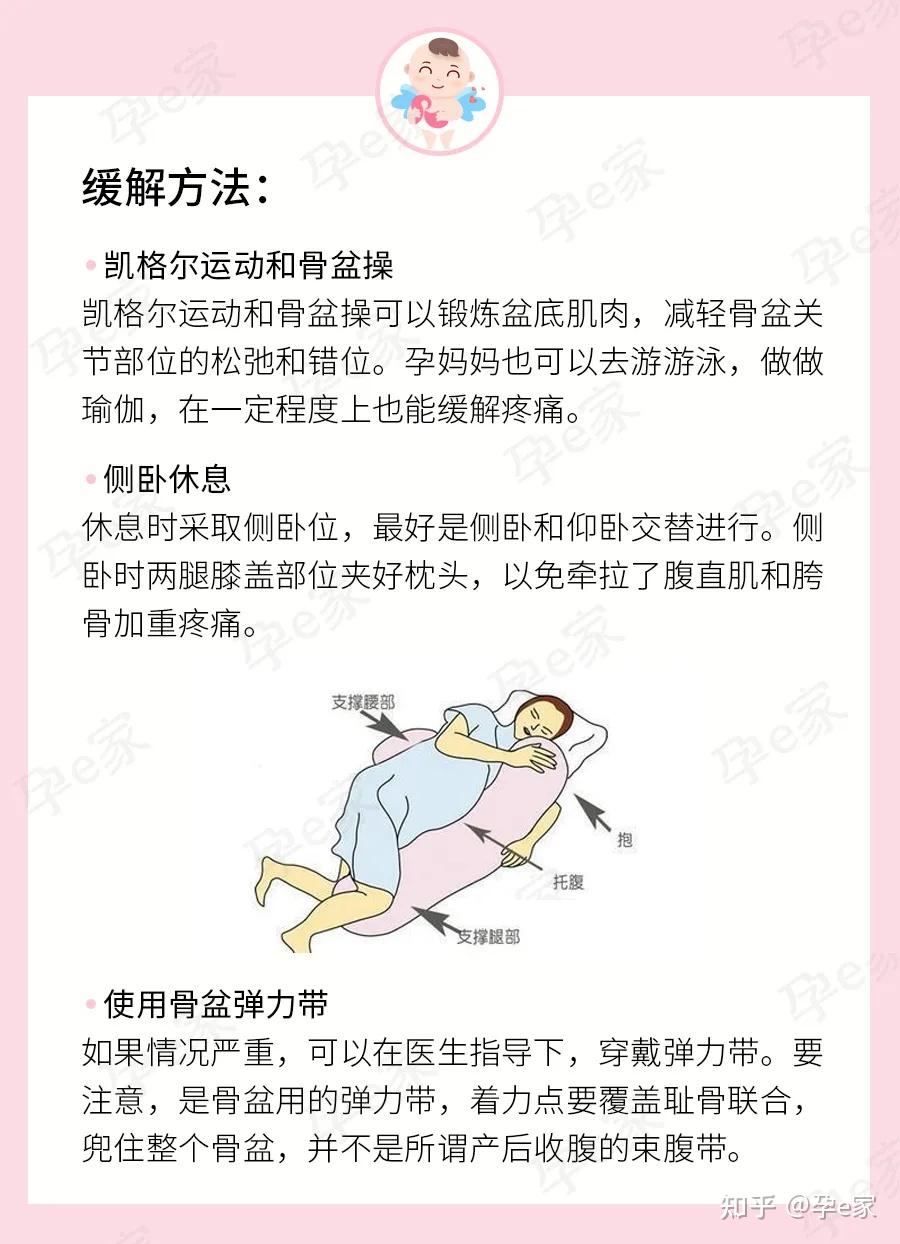 孕期耻骨疼怎么办图片