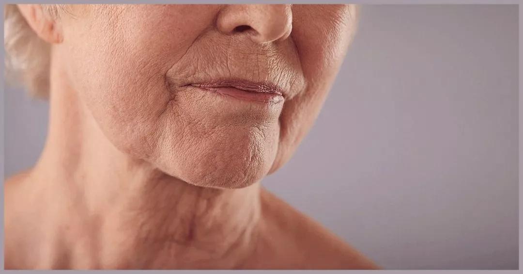 怎样解决皮肤老化松弛的问题护肤方案在这里